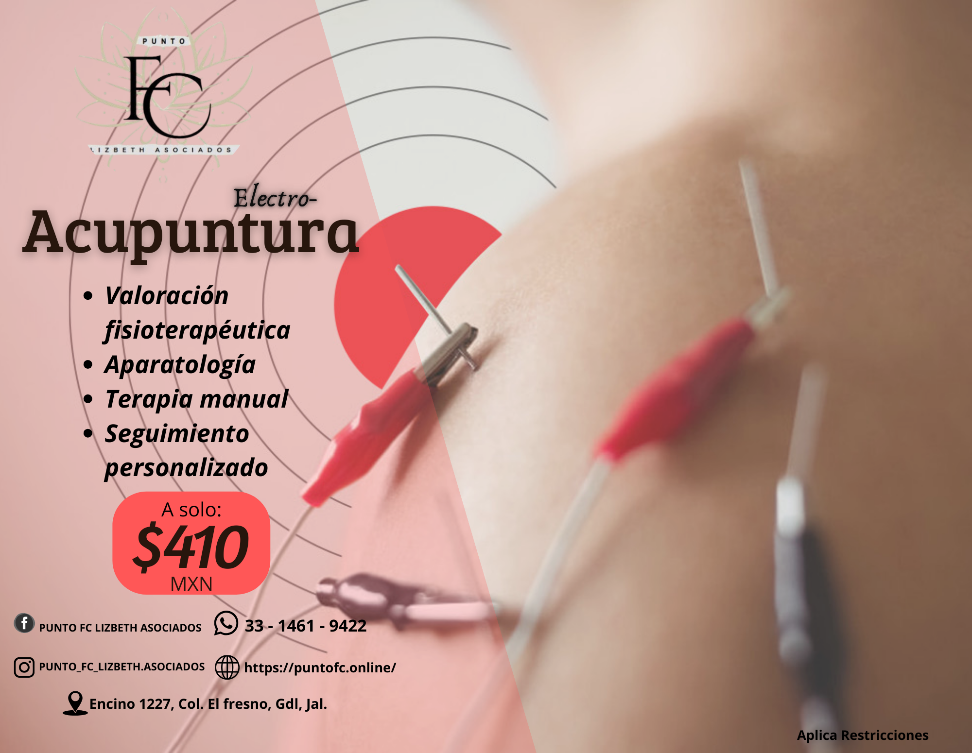 Electro acupuntura