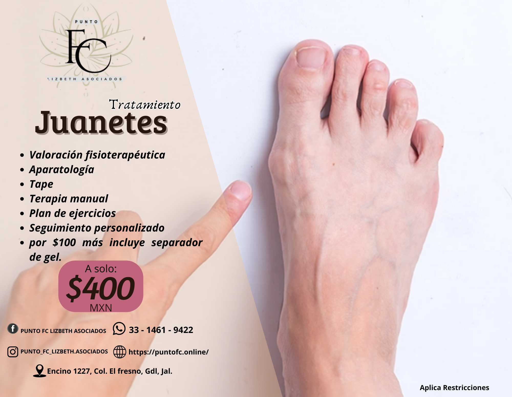 Tratamiento Juanetes
