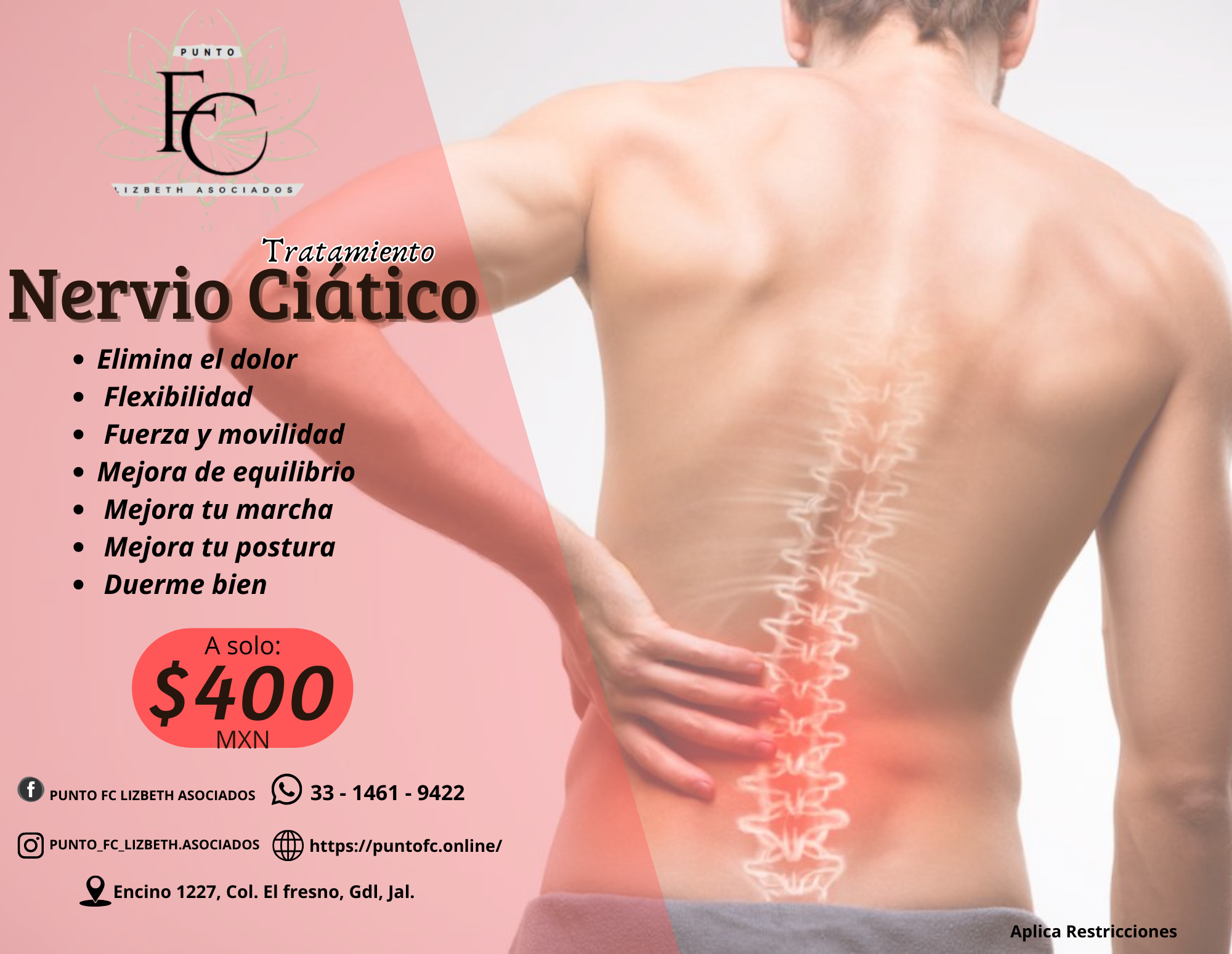 Tratamiento de Nervio Ciático